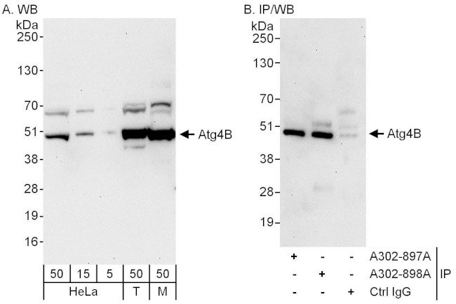 Atg4B Antibody in Western Blot (WB)