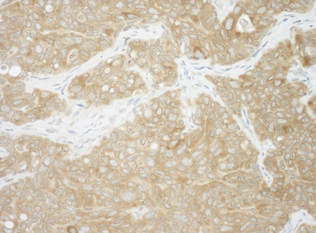 AUP1 Antibody in Immunohistochemistry (Paraffin) (IHC (P))