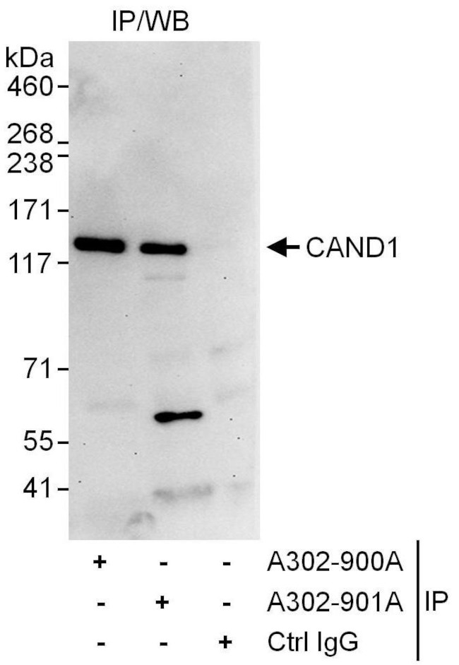CAND1 Antibody in Immunoprecipitation (IP)