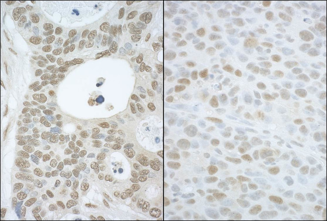 CAND1 Antibody in Immunohistochemistry (Paraffin) (IHC (P))
