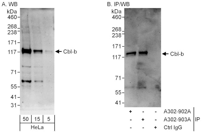 Cbl-b Antibody in Western Blot (WB)