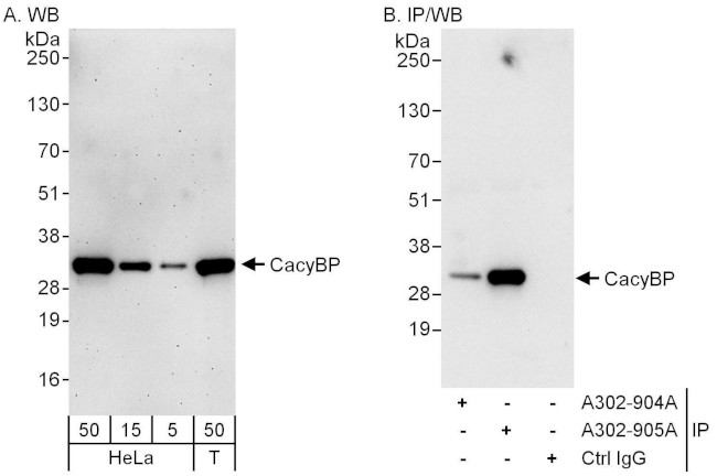 CacyBP Antibody in Western Blot (WB)