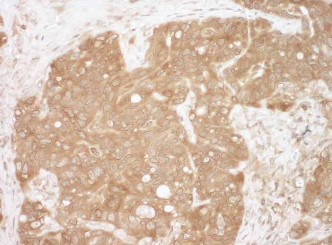 CacyBP Antibody in Immunohistochemistry (Paraffin) (IHC (P))
