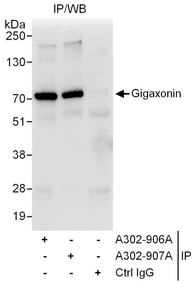 Gigaxonin Antibody in Immunoprecipitation (IP)