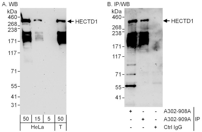 HECTD1 Antibody in Western Blot (WB)
