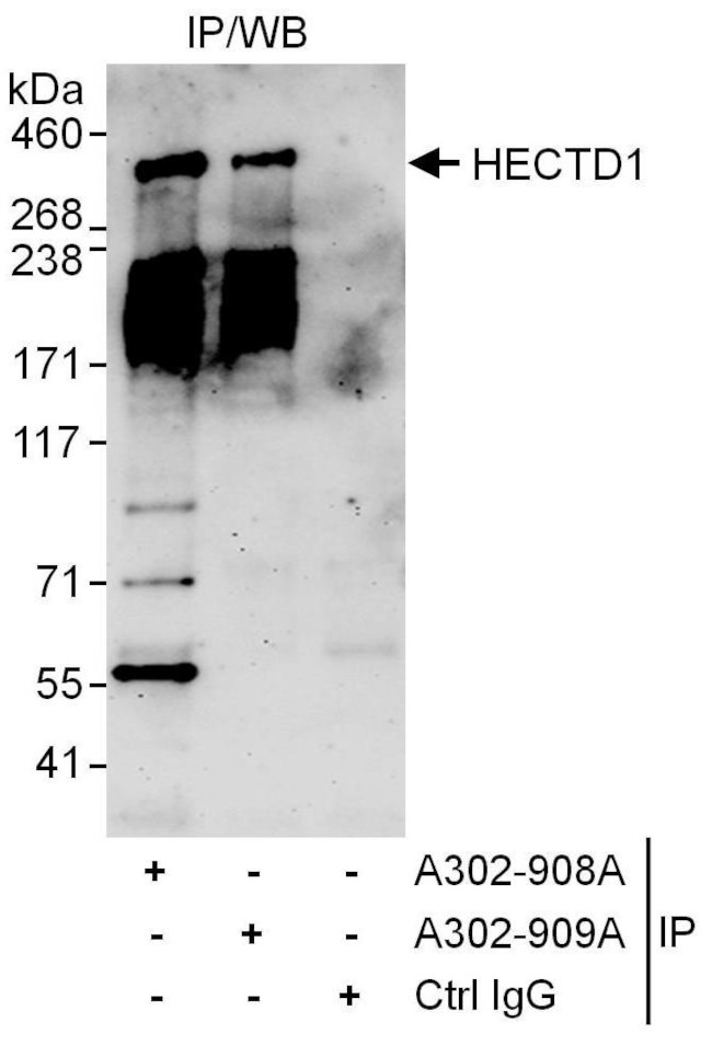 HECTD1 Antibody in Immunoprecipitation (IP)