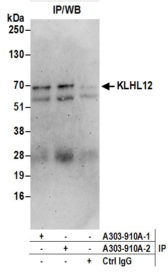 KLHL12 Antibody in Immunoprecipitation (IP)