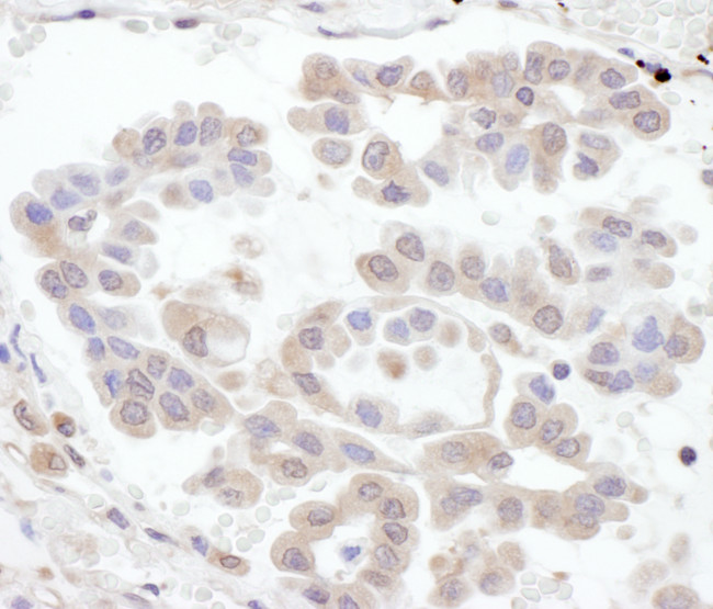RABGEF1 Antibody in Immunohistochemistry (Paraffin) (IHC (P))