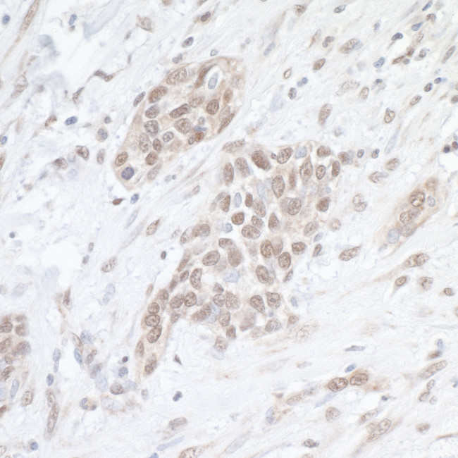 SAE1 Antibody in Immunohistochemistry (Paraffin) (IHC (P))