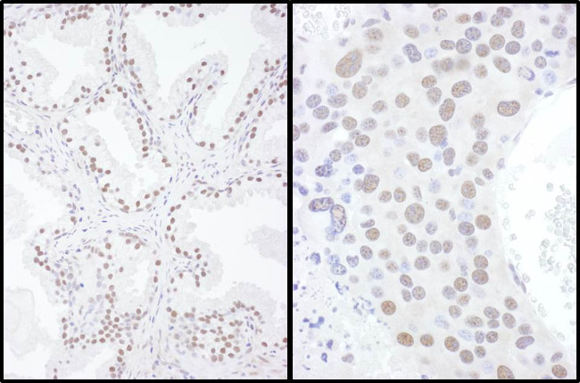 SAE2 Antibody in Immunohistochemistry (Paraffin) (IHC (P))