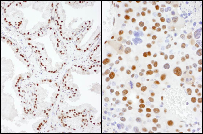 SAE2 Antibody in Immunohistochemistry (Paraffin) (IHC (P))