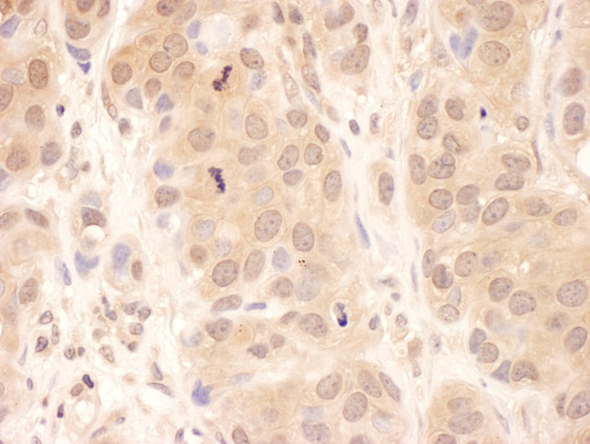 USP8 Antibody in Immunohistochemistry (Paraffin) (IHC (P))