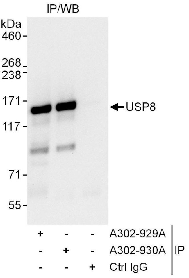 USP8 Antibody in Immunoprecipitation (IP)