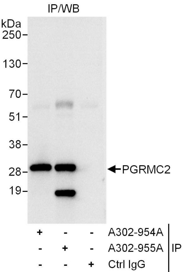 PGRMC2 Antibody in Immunoprecipitation (IP)