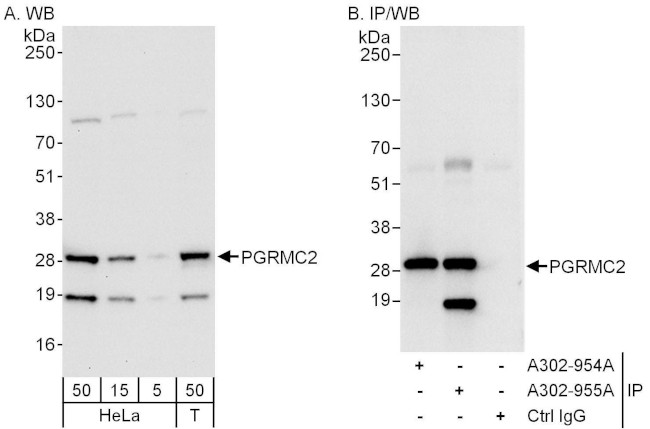 PGRMC2 Antibody in Western Blot (WB)