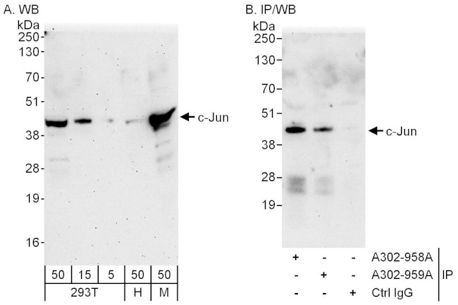 c-Jun Antibody in Western Blot (WB)
