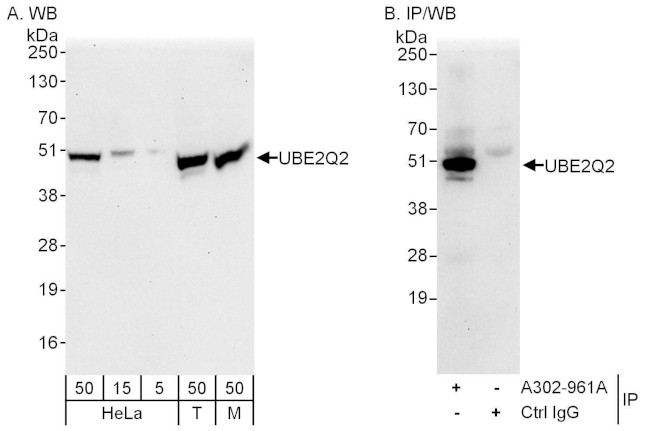UBE2Q2 Antibody in Western Blot (WB)