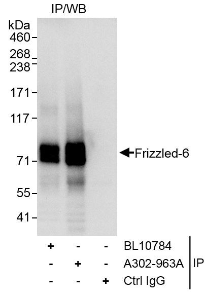Frizzled-6 Antibody in Immunoprecipitation (IP)