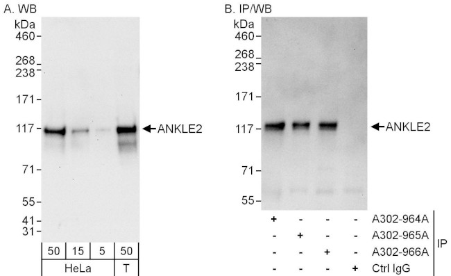 ANKLE2 Antibody in Western Blot (WB)