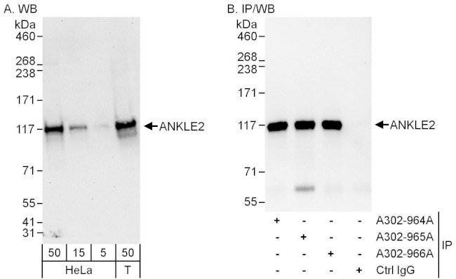 ANKLE2 Antibody in Western Blot (WB)