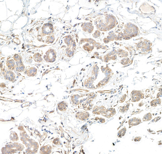 DGKzeta Antibody in Immunohistochemistry (Paraffin) (IHC (P))