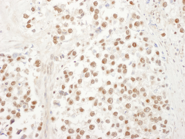 UBL7 Antibody in Immunohistochemistry (Paraffin) (IHC (P))