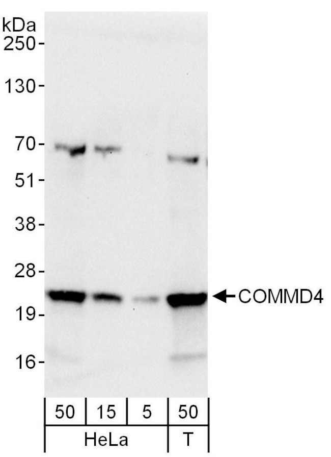 COMMD4 Antibody in Western Blot (WB)