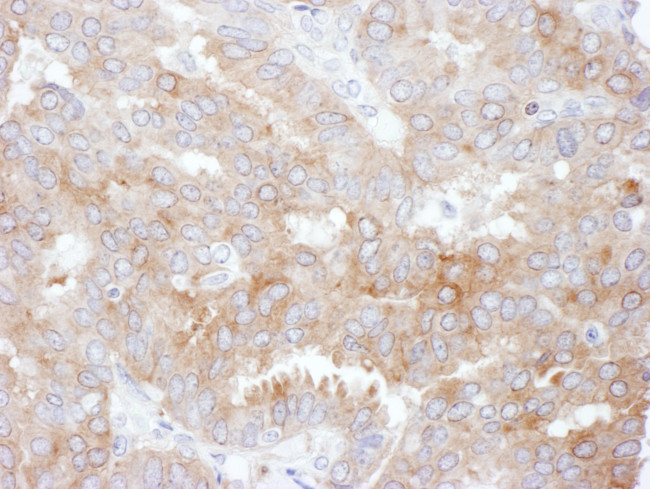 NHERF1 Antibody in Immunohistochemistry (Paraffin) (IHC (P))