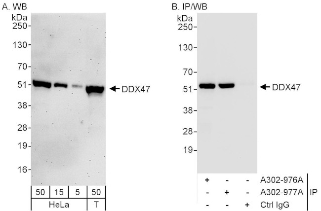 DDX47 Antibody in Western Blot (WB)