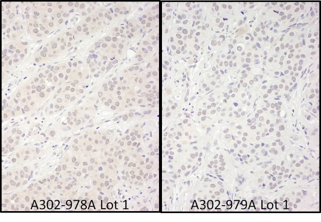 DDX56 Antibody in Immunohistochemistry (Paraffin) (IHC (P))