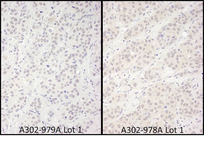 DDX56 Antibody in Immunohistochemistry (Paraffin) (IHC (P))