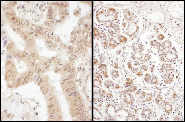 eIF2B delta/EIF2B4 Antibody in Immunohistochemistry (Paraffin) (IHC (P))