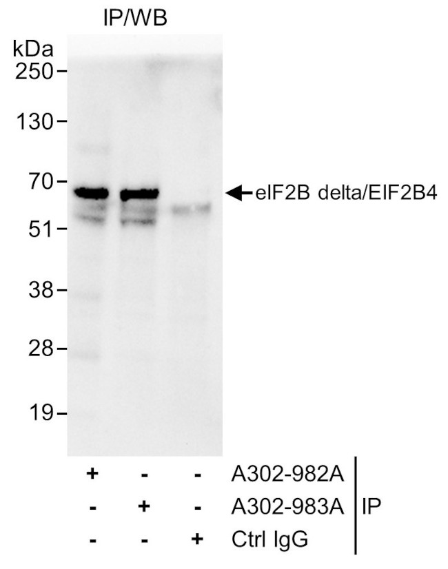 eIF2B delta/EIF2B4 Antibody in Immunoprecipitation (IP)