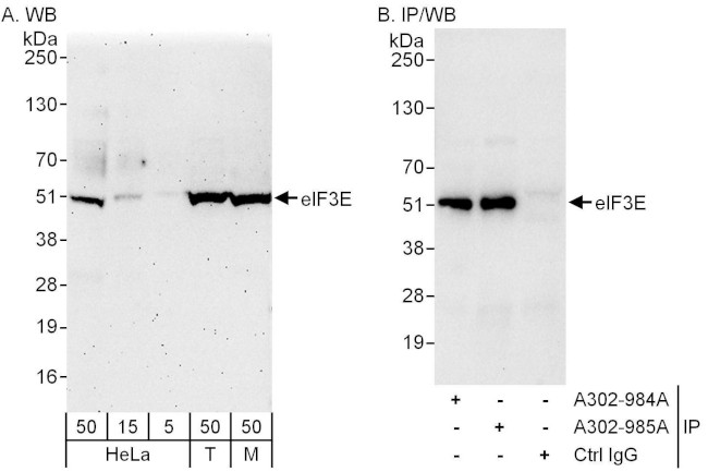 eIF3E Antibody in Western Blot (WB)