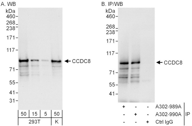 CCDC8 Antibody in Western Blot (WB)