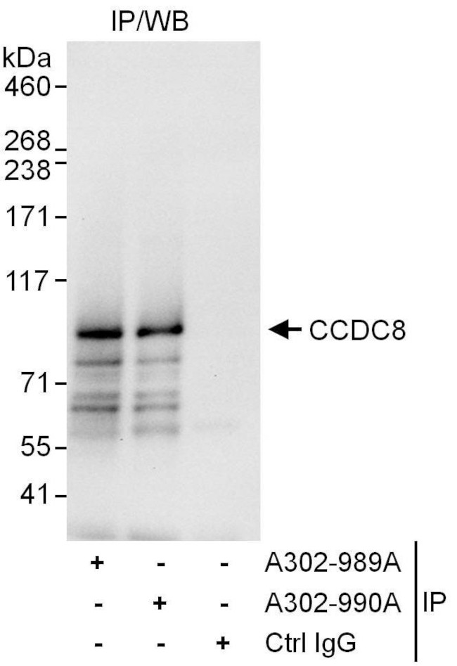 CCDC8 Antibody in Immunoprecipitation (IP)