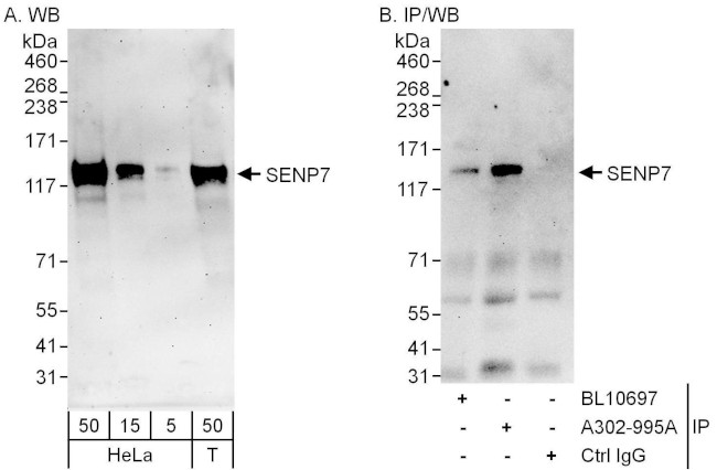 SENP7 Antibody in Western Blot (WB)