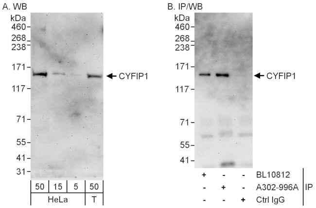 CYFIP1 Antibody in Western Blot (WB)