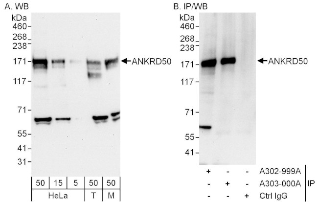ANKRD50 Antibody in Western Blot (WB)
