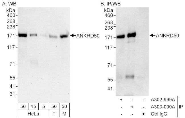 ANKRD50 Antibody in Western Blot (WB)