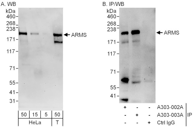 ARMS Antibody in Western Blot (WB)