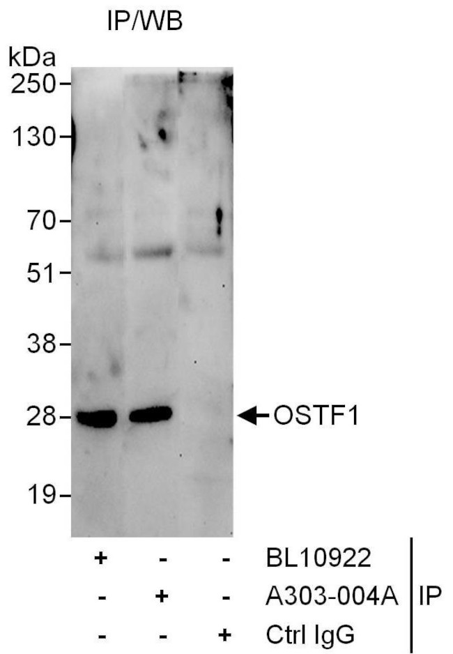 OSTF1 Antibody in Immunoprecipitation (IP)