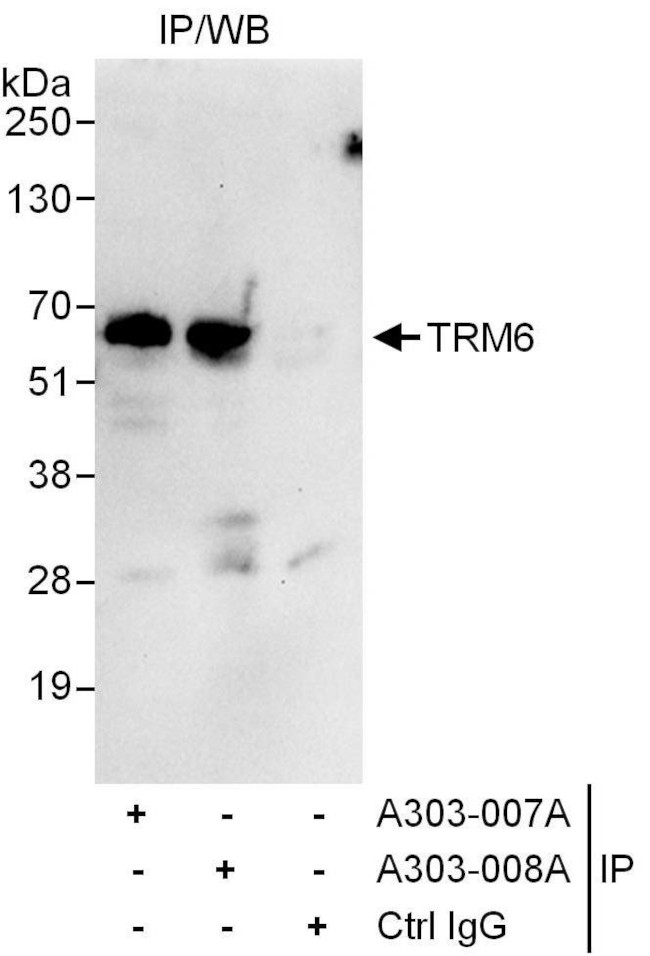 TRM6 Antibody in Immunoprecipitation (IP)