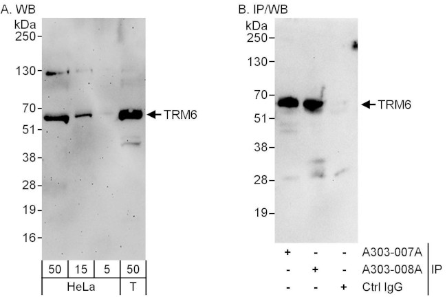 TRM6 Antibody in Western Blot (WB)