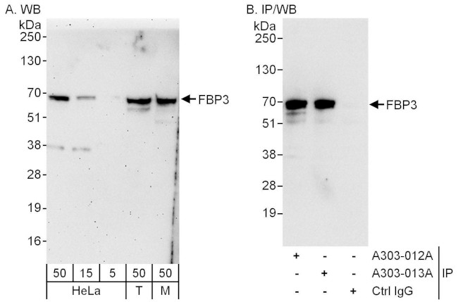 FBP3 Antibody in Western Blot (WB)