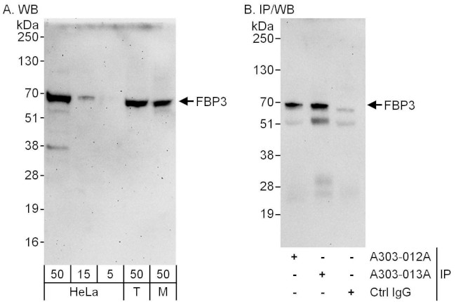 FBP3 Antibody in Western Blot (WB)