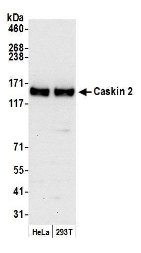 Caskin 2 Antibody in Western Blot (WB)