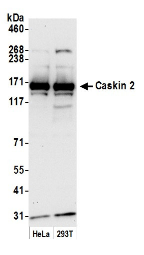 Caskin 2 Antibody in Western Blot (WB)