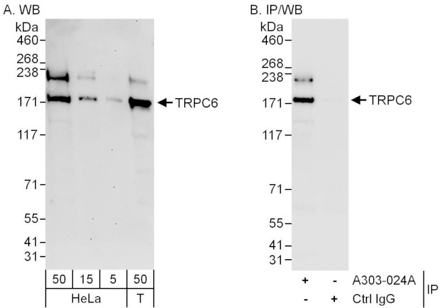 TRPC6 Antibody in Western Blot (WB)