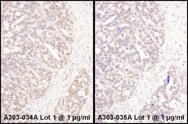 ATF1 Antibody in Immunohistochemistry (Paraffin) (IHC (P))